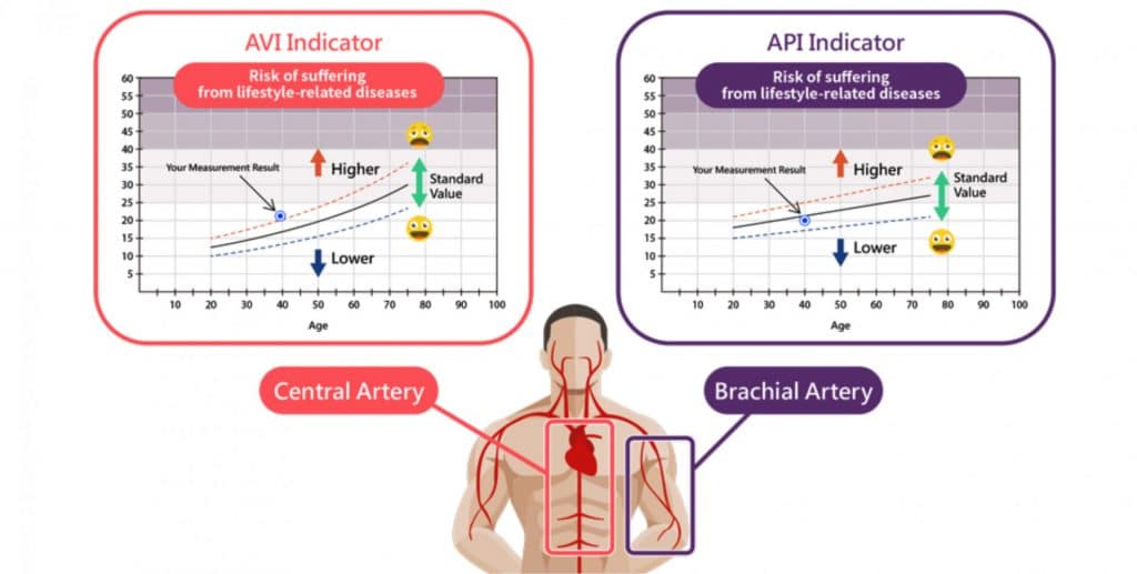 Cardiovascular diseases