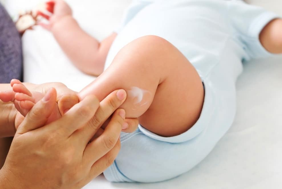 Eczema! The perfect solution for your baby